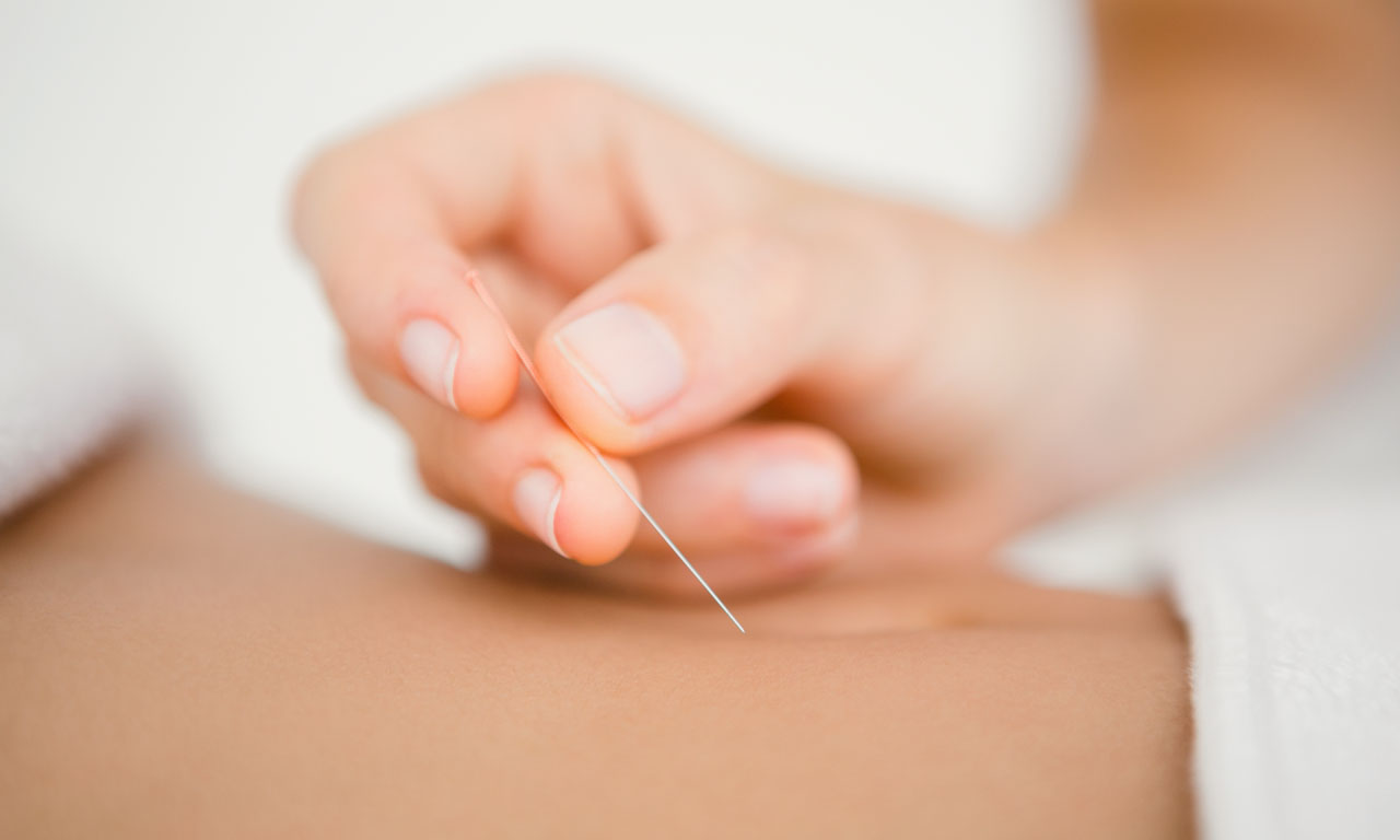 Acupuncture Treatment in Henley, Newbury, Bracknell, & Hurst - Copy