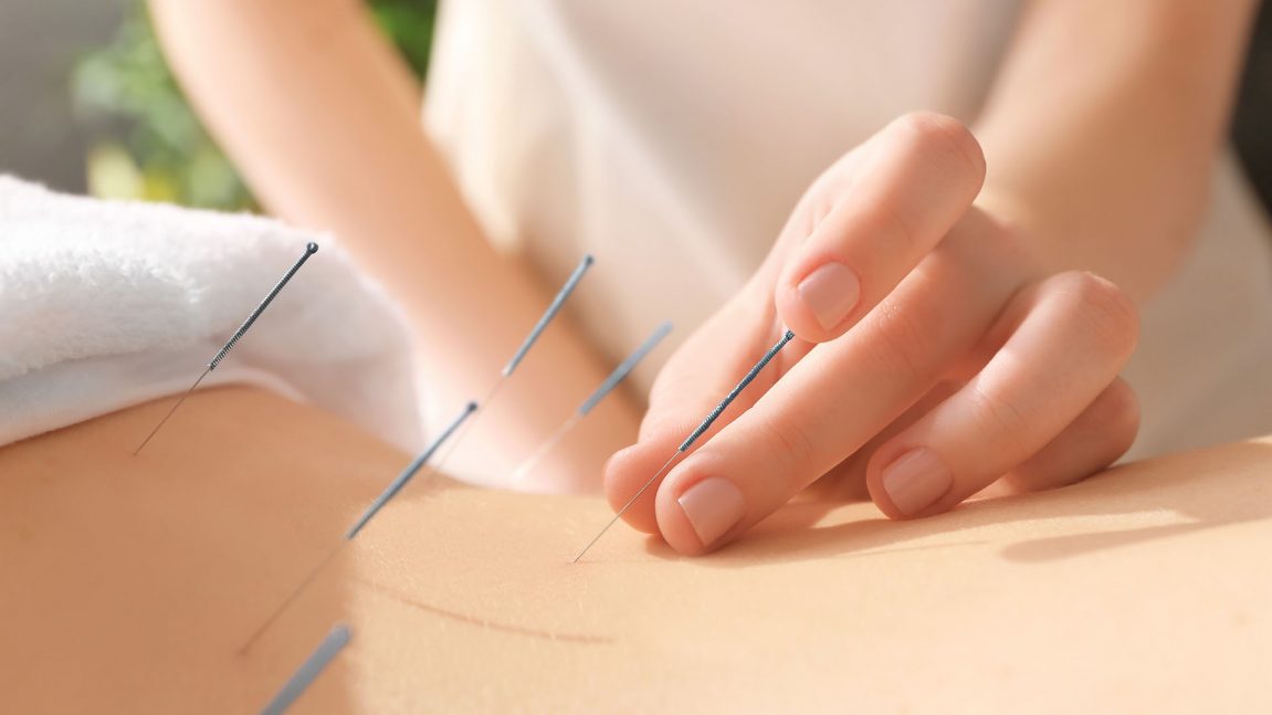 acupuncture caversham reading berkshire