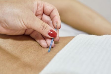 acupuncture maidenhead berkshire