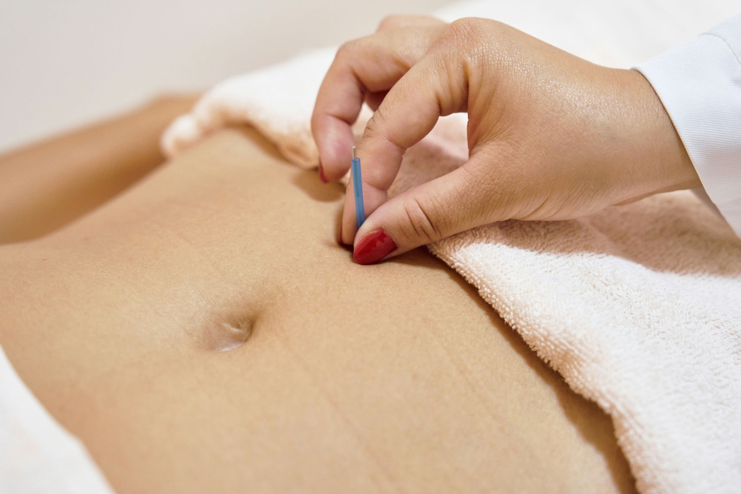 acupuncture treatment maidenhead
