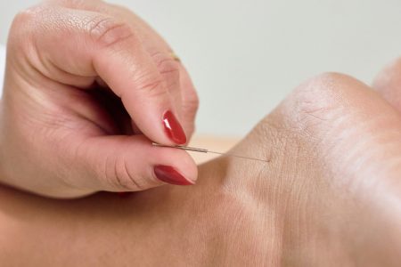 acupuncturist near me maidenhead