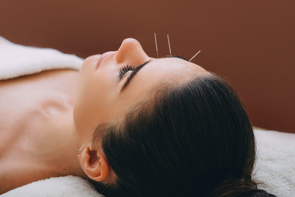 Cosmetic Acupuncturist in Reading Karolina Acupuncture