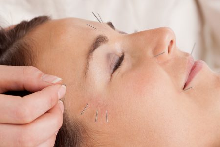 cosmetic facial acupuncture reading