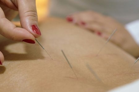 maidenhead acupuncture