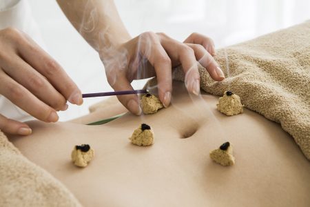 Moxibustion treatment to stimulate blood circulation